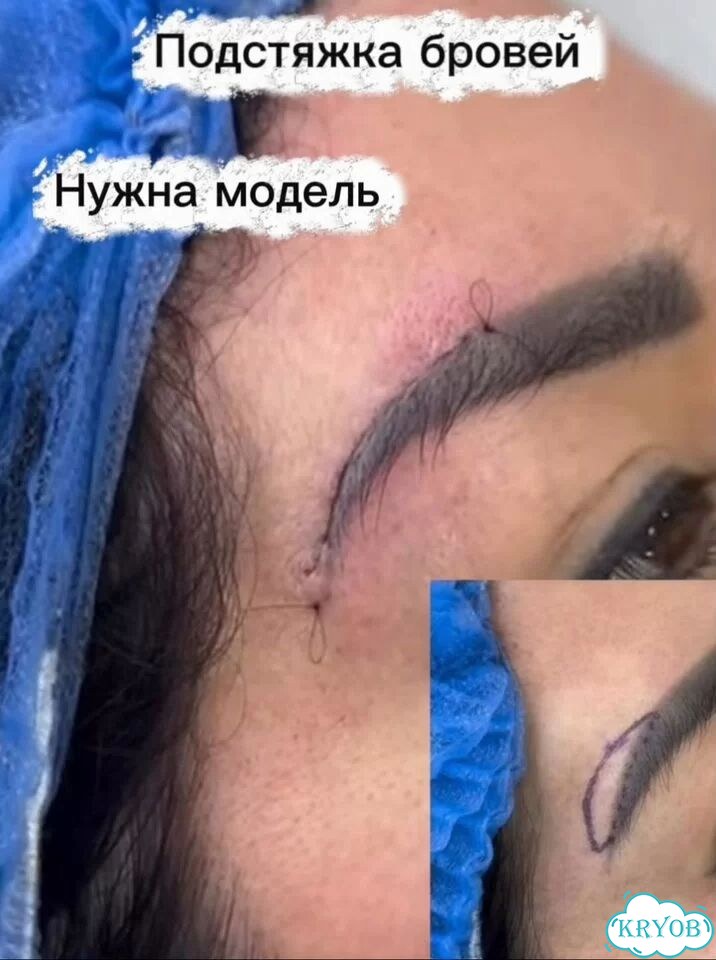Услуги косметолога уколы красоты фото 2