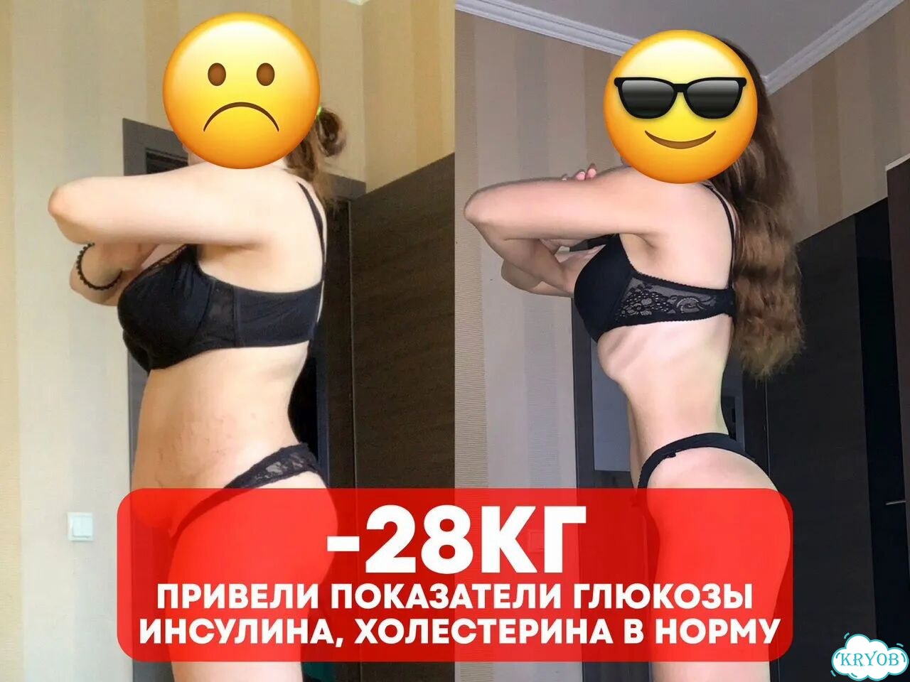 Диетолог Нутрициолог Похудение Уберу целлюлит фото 3